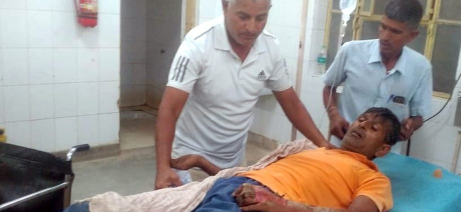 कोटपूतली: युवक को पकड़ी बिजली, जयपुर रैफर कोटपूतली: युवक को पकड़ी बिजली, जयपुर रैफर