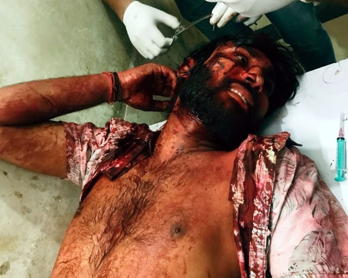 KOTPUTLI-BEHROR: घायल युवक की रिपोर्ट दर्ज करने में पुलिस की अनदेखी! KOTPUTLI-BEHROR: घायल युवक की रिपोर्ट दर्ज करने में पुलिस की अनदेखी!