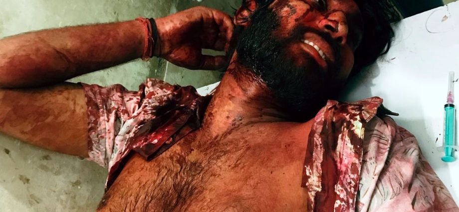 KOTPUTLI-BEHROR: घायल युवक की रिपोर्ट दर्ज करने में पुलिस की अनदेखी! KOTPUTLI-BEHROR: घायल युवक की रिपोर्ट दर्ज करने में पुलिस की अनदेखी!